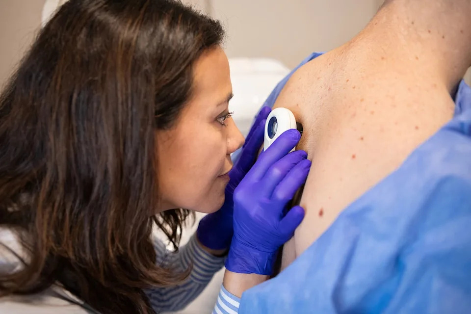 A person’s gut bacteria could determine their risk of getting skin cancer again after being treated for the disease, a new study has found (Getty Images/iStock)