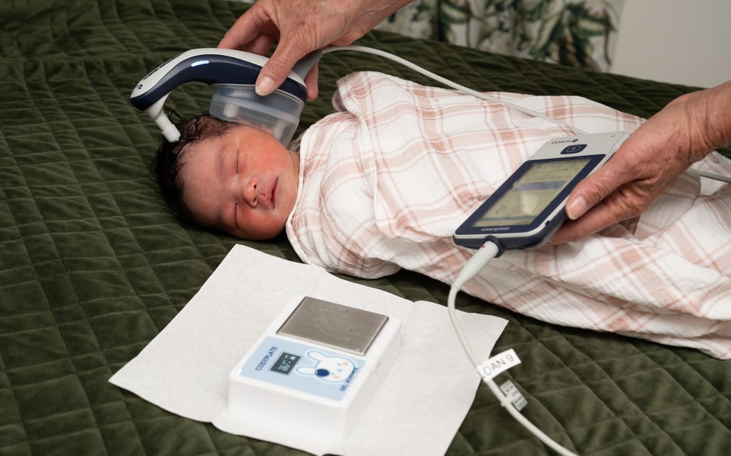 Baby Lihona sleeps while she has her hearing checked.