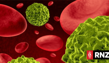 Blood Cancer New Zealand says country not keeping up with treatments internationally