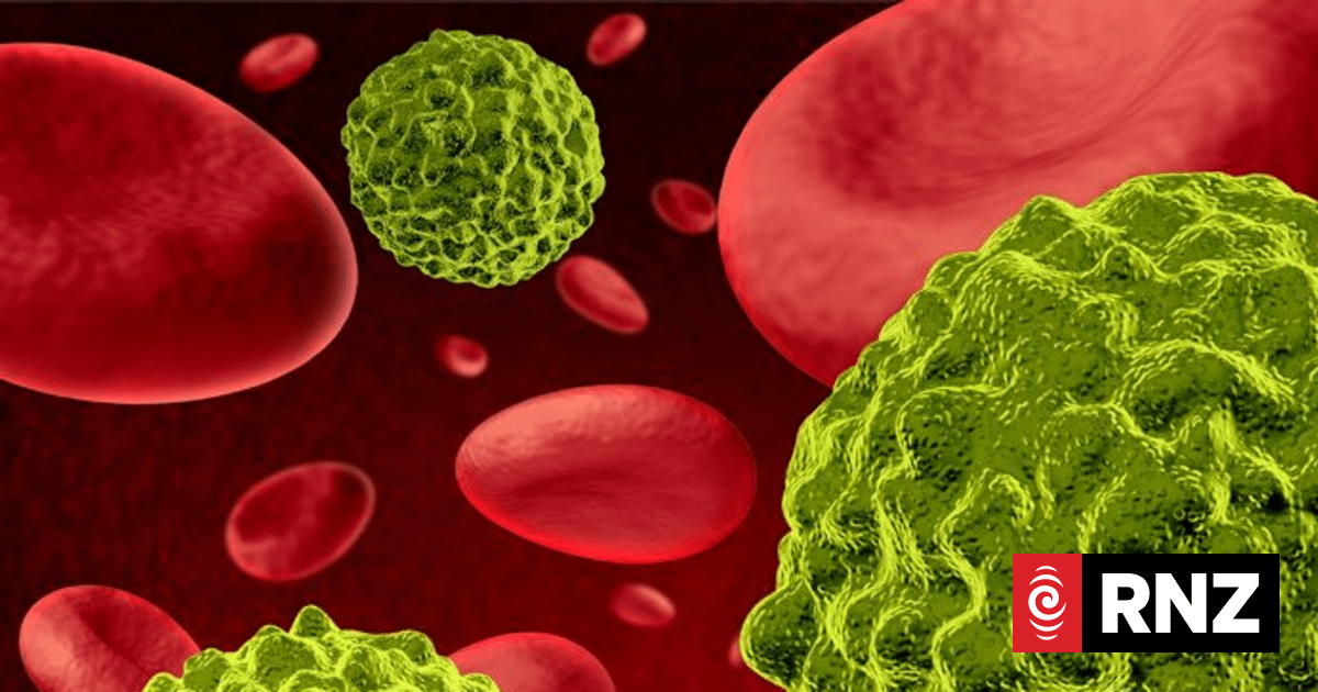 Blood Cancer New Zealand says country not keeping up with treatments internationally