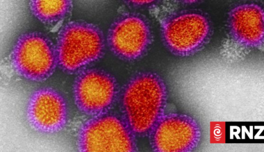 What to know as flu strain 'super-k' nears New Zealand shores