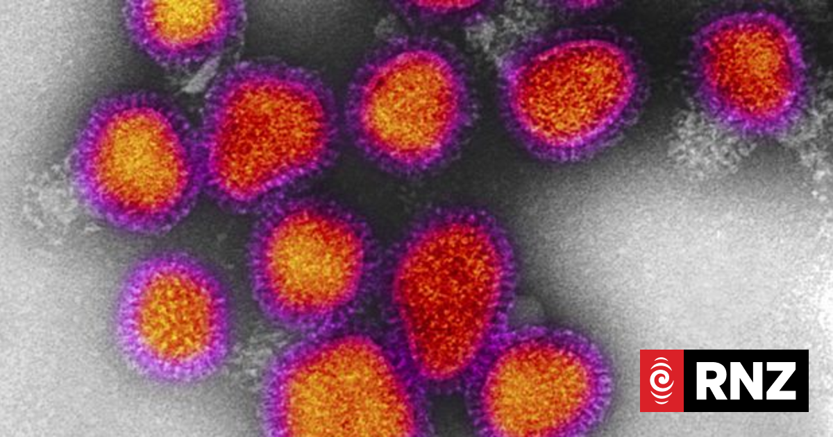 What to know as flu strain 'super-k' nears New Zealand shores