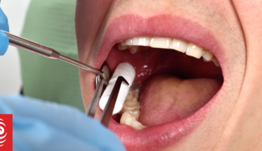 Auckland dentist censured after self-prescribing fentanyl to feed his growing habit