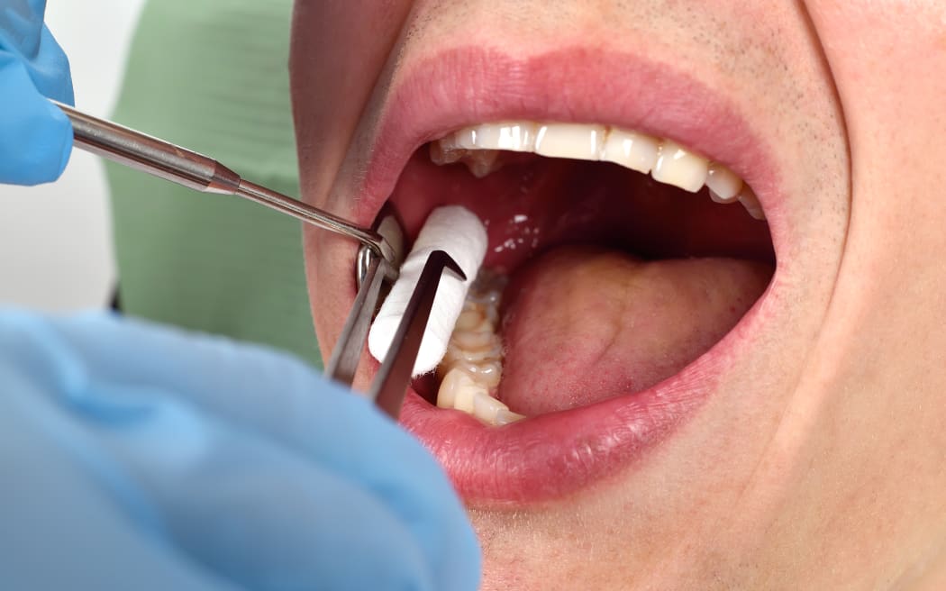 The dentist inserts the swab into the patient's mouth