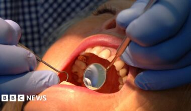 A woman with her mouth open during a dental inspection. The dentist is wearing blue surgical gloves and is holding dental instruments in the patient's mouth. while a light shines on her face.