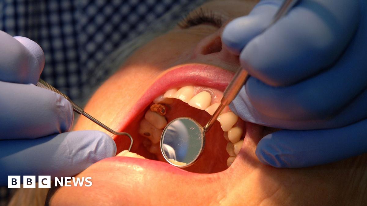 A woman with her mouth open during a dental inspection. The dentist is wearing blue surgical gloves and is holding dental instruments in the patient's mouth. while a light shines on her face.