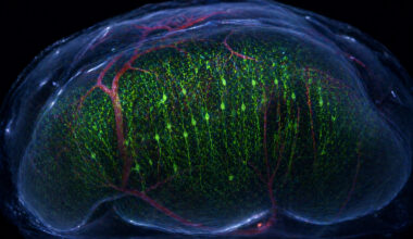 Midnight Lab Experiment Turns Living Mouse Brain Transparent