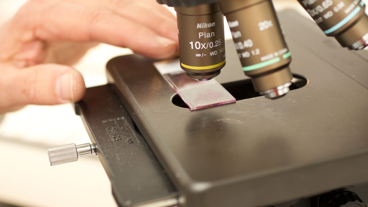 Awanui Labs breached code after Invercargill woman’s cancer missed twice