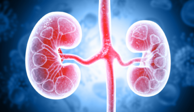 Immune linked high risk diabetic kidney disease found
