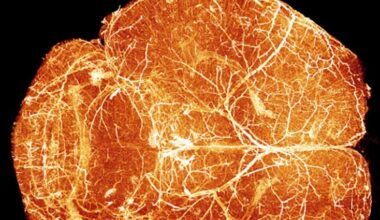 Putting Brain Development on the Map