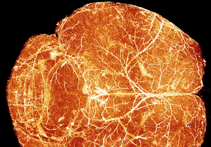 Putting Brain Development on the Map