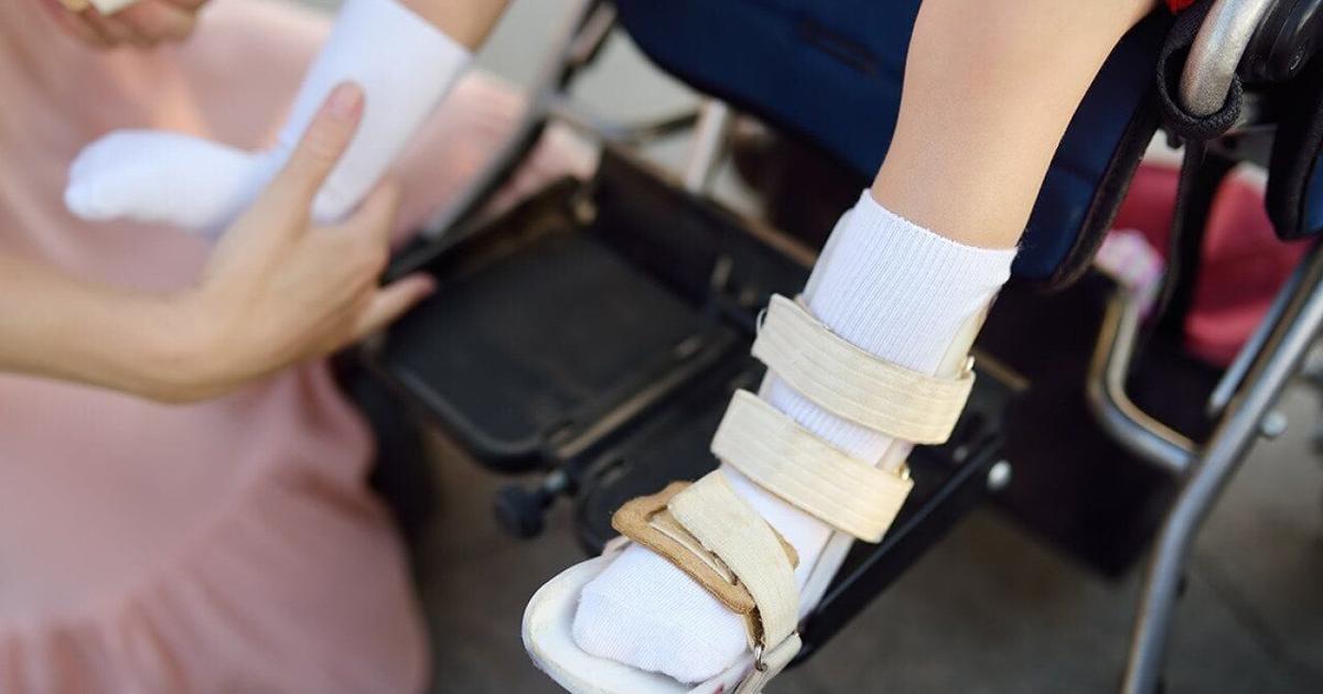 Stem cell therapy for cerebral palsy moves closer to US trials | Health