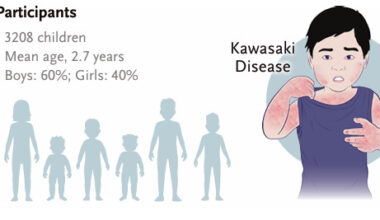 Overuse of steroids in Kawasaki challenged