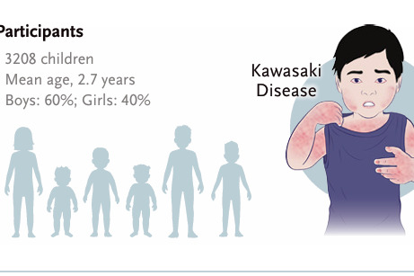 Overuse of steroids in Kawasaki challenged