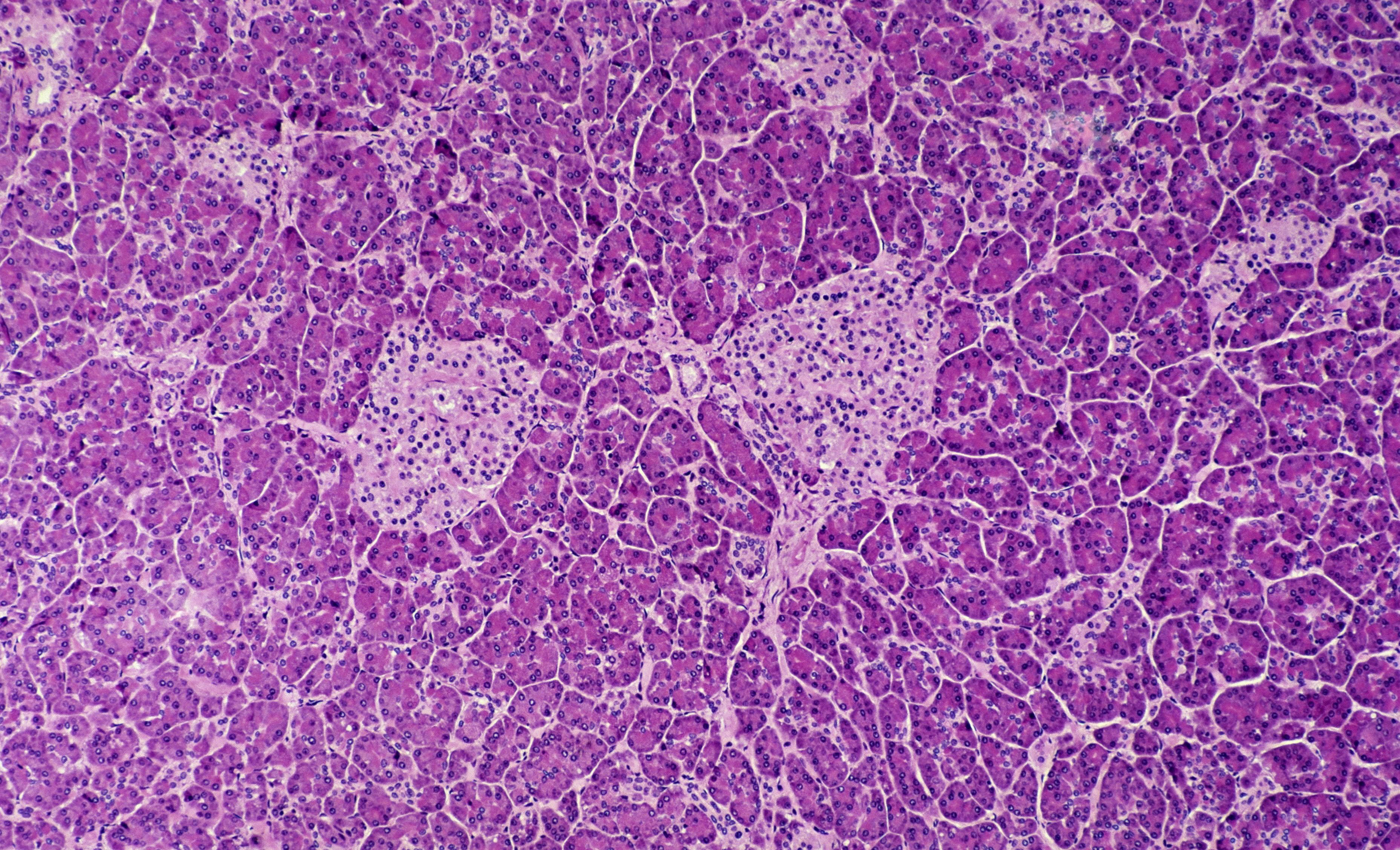 Islets of Langerhans (lightly stained, pink areas - composed of alpha and beta cells, endocrine tissue), and exocrine tissue (darker, surrounding tissue, secretes digestive enzymes)
