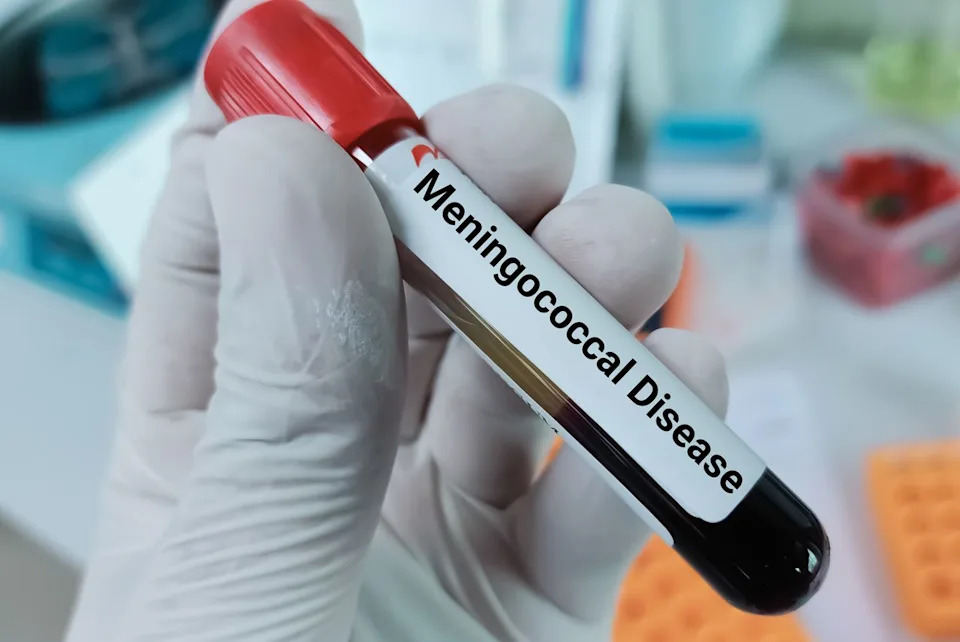 Stock photo of a blood sample for Meningococcal disease test.Credit: Getty