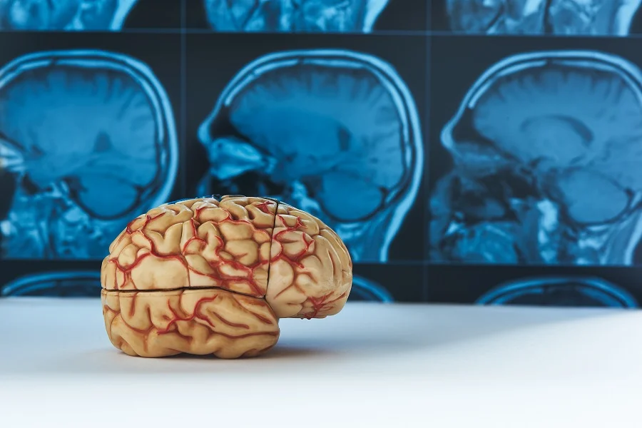 Brain model