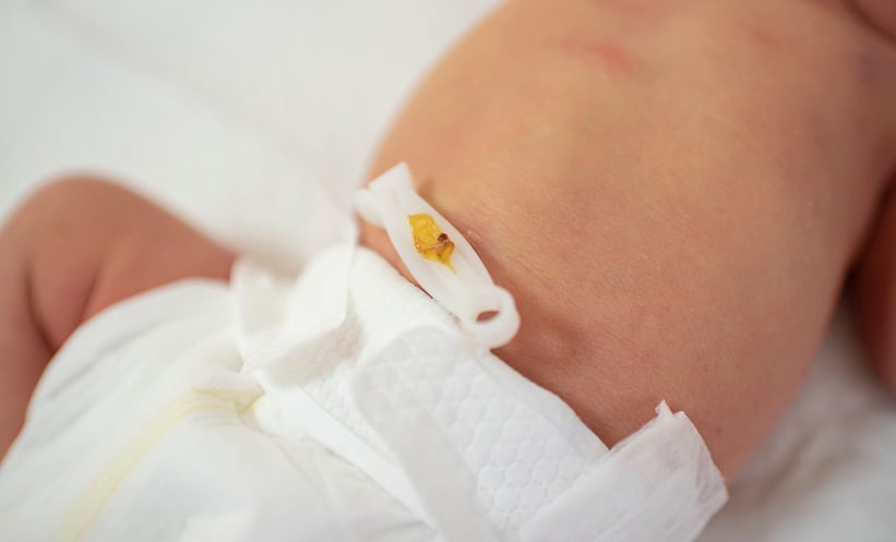 Umbilical Cord Antiseptics Reduce Neonatal Mortality