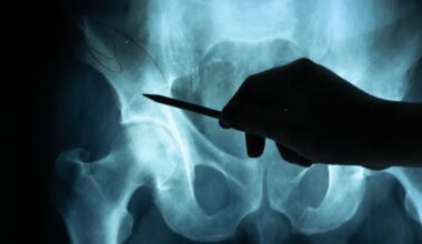 Health NZ discovers 180 radiology reports weren’t sent back to doctors