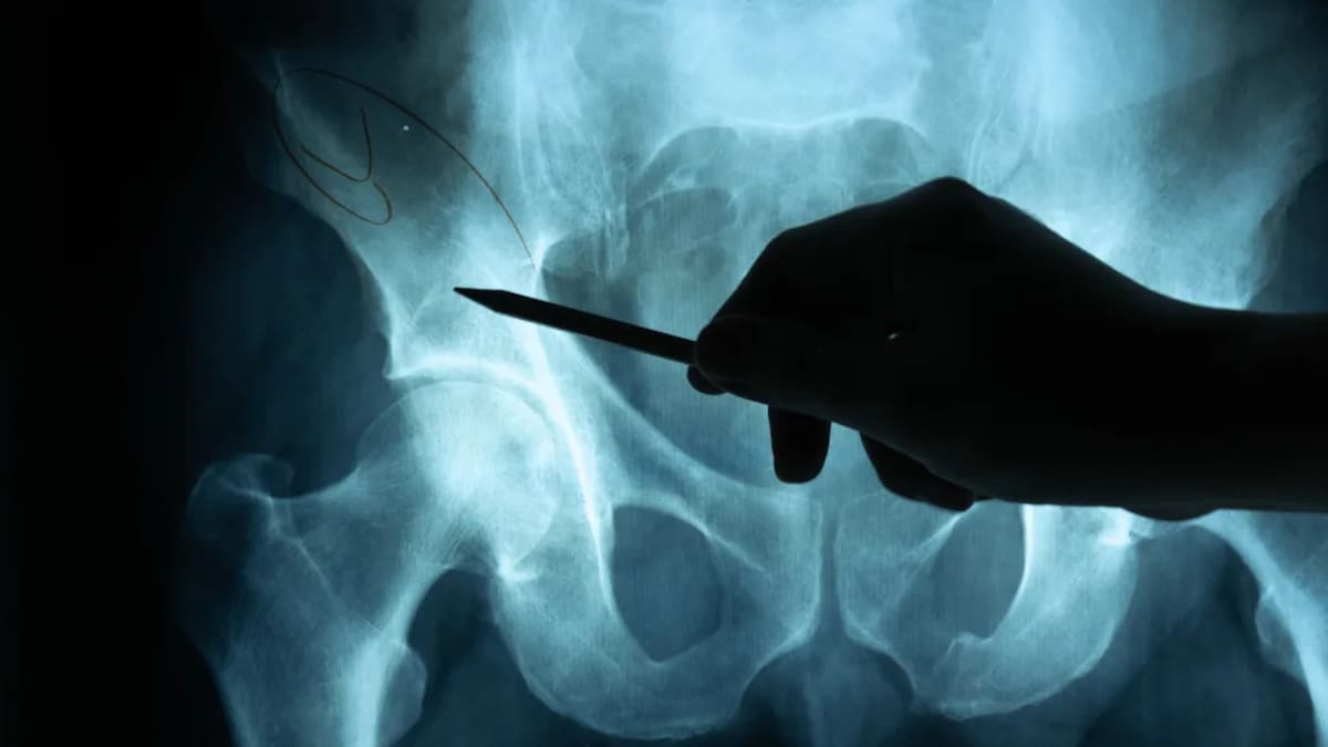Health NZ discovers 180 radiology reports weren’t sent back to doctors