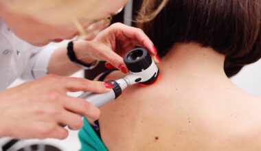 Doctor examining birthmarks and moles patient. examination of birthmarks and moles.