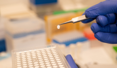 Shanshan Liu and Mark Gad developed a liposome-based transport assay to characterize SLC33A1 transport activity. (Credit: Lori Chertoff)
