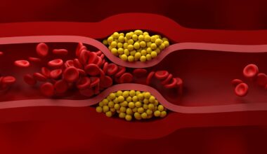 US Cardiologists Have Just Published New Guidelines For Managing Cholesterol : ScienceAlert