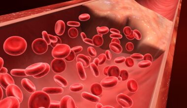 New guidelines and follow-up standards improve pulmonary embolism outcomes