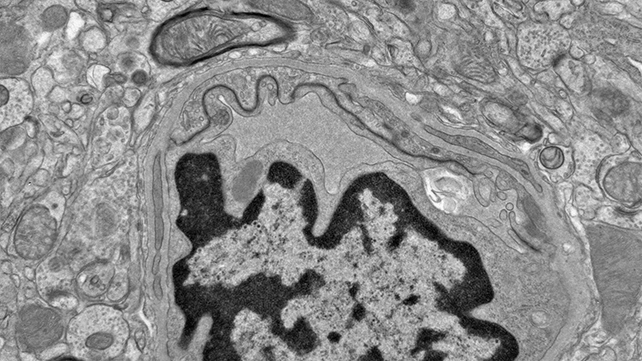 Brain tissue scan