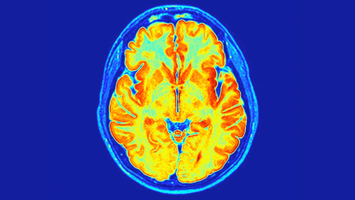 Scientists Have Found a New Neurodevelopmental Disorder Hidden in Our Genes : ScienceAlert