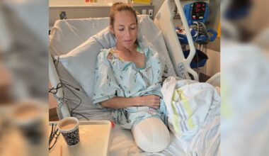 Central Hawke’s Bay mum has leg removed in fight against clear cell sarcoma pain