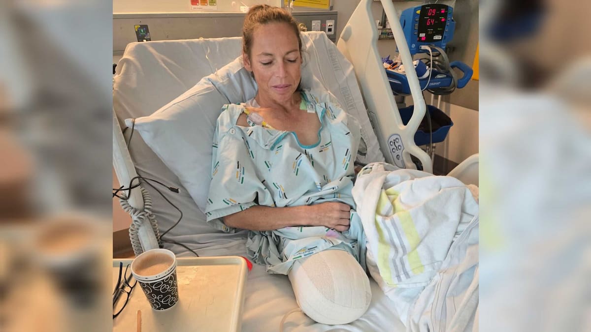 Central Hawke’s Bay mum has leg removed in fight against clear cell sarcoma pain