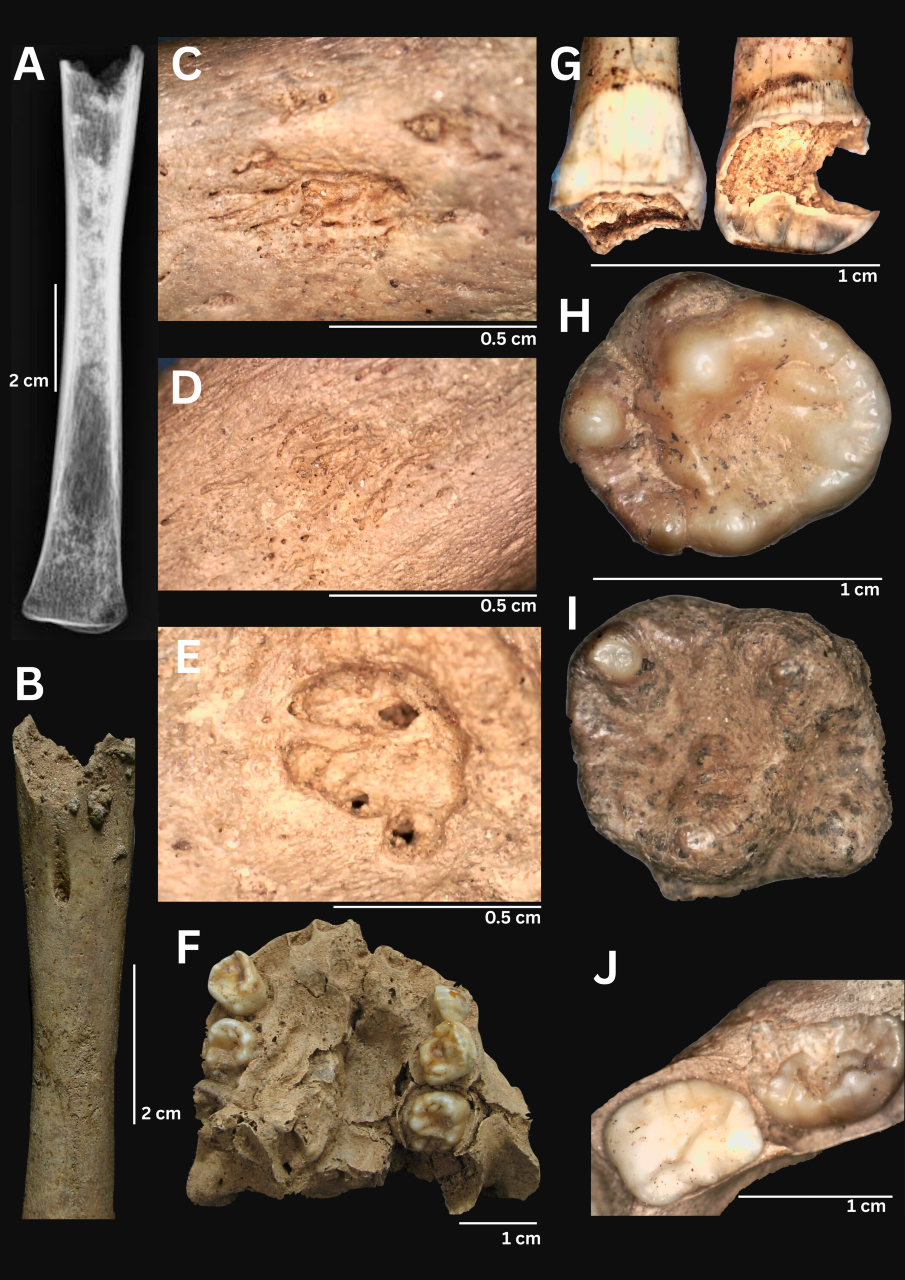 A collage of images labeled A-J, each showing a different brown bone or tooth fragment