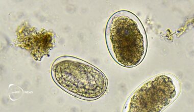 🪱 Hookworm vaccine reduces infection in trial – could help millions with anemia