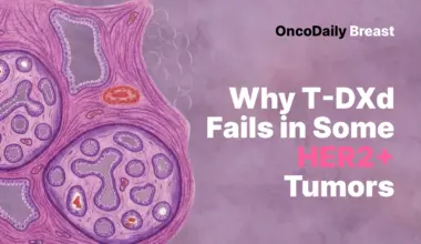 HER2 Heterogeneity in Breast Cancer May Explain Why Some Tumors Escape T-DXd