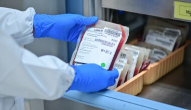 close up blood bag in laboratory medical concept. blood, donate blood, blood bank.