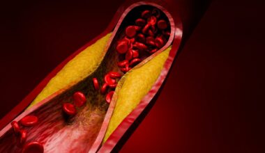 Evolocumab trial could reshape how doctors treat high-risk cholesterol patients