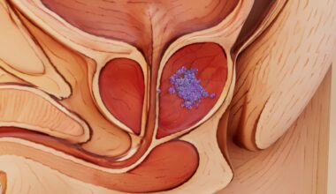 Study: The anti-obesogenic metabolite, Lac-Phe, is elevated by metformin treatment in prostate cancer patients. Image Credit: Julien Tromeur / Shutterstock