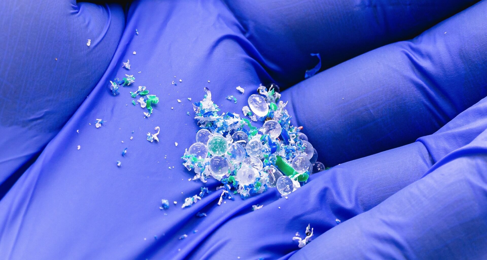 Microplastics found in human bile may be associated with gallstones