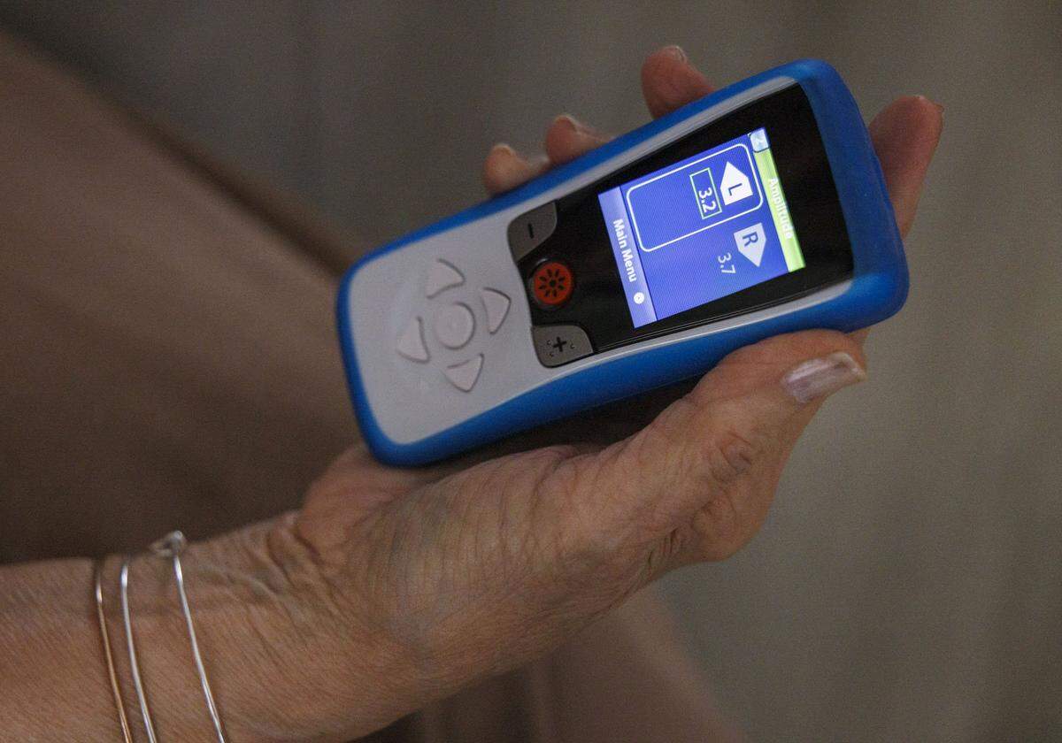 Ivonne Gonzalez holds her DBS, deep brain stimulation, device that they say changes the intensity of the electric current that’s running through the brain inside her home on Tuesday, April 28, 2026, in Miami, Fla. 