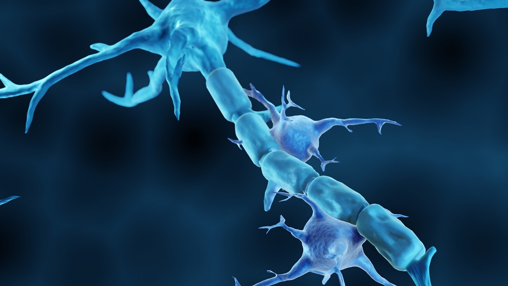Microglia among neurons