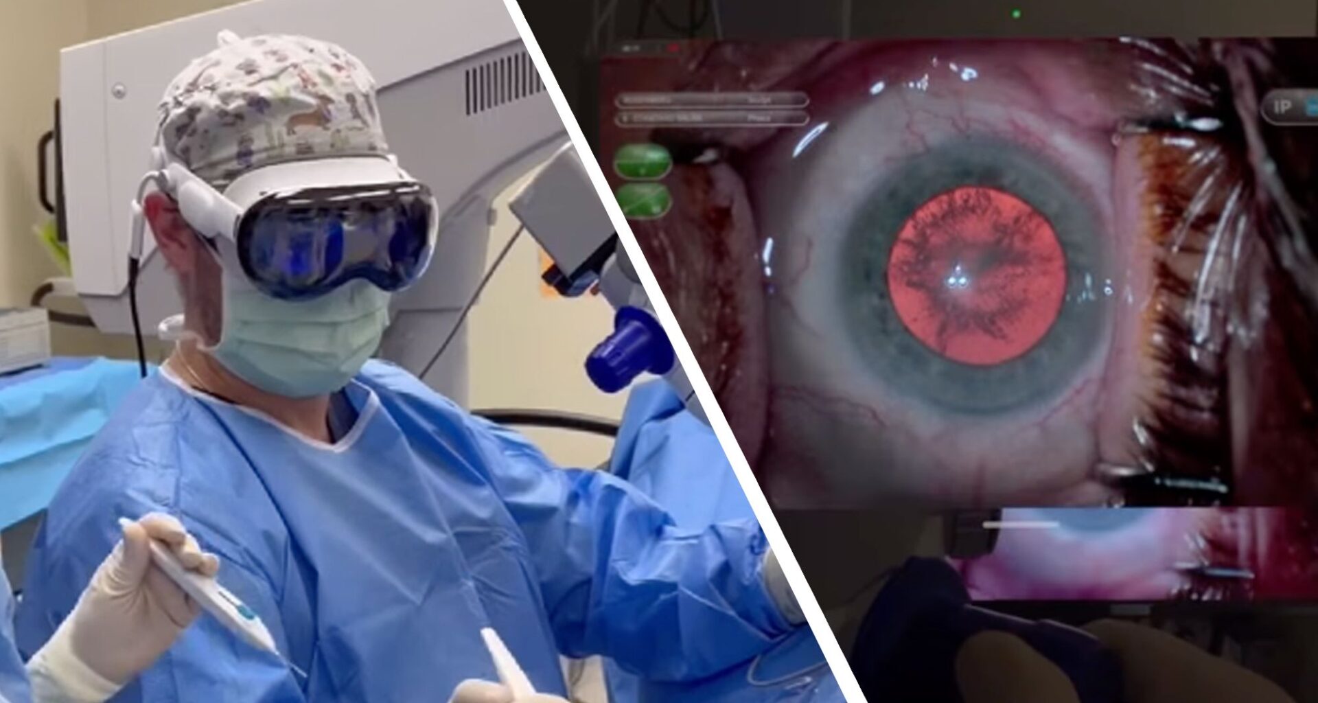 ‘Safer, smarter, and more connected’: Apple’s Vision Pro used in world-first VR-assisted surgery, and it could be the future of medicine