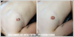 An example of scar camoflage areola tattoo by Kaysie Anderson, founder and owner of Exuvium Studios in Portland, in an undated provided image.