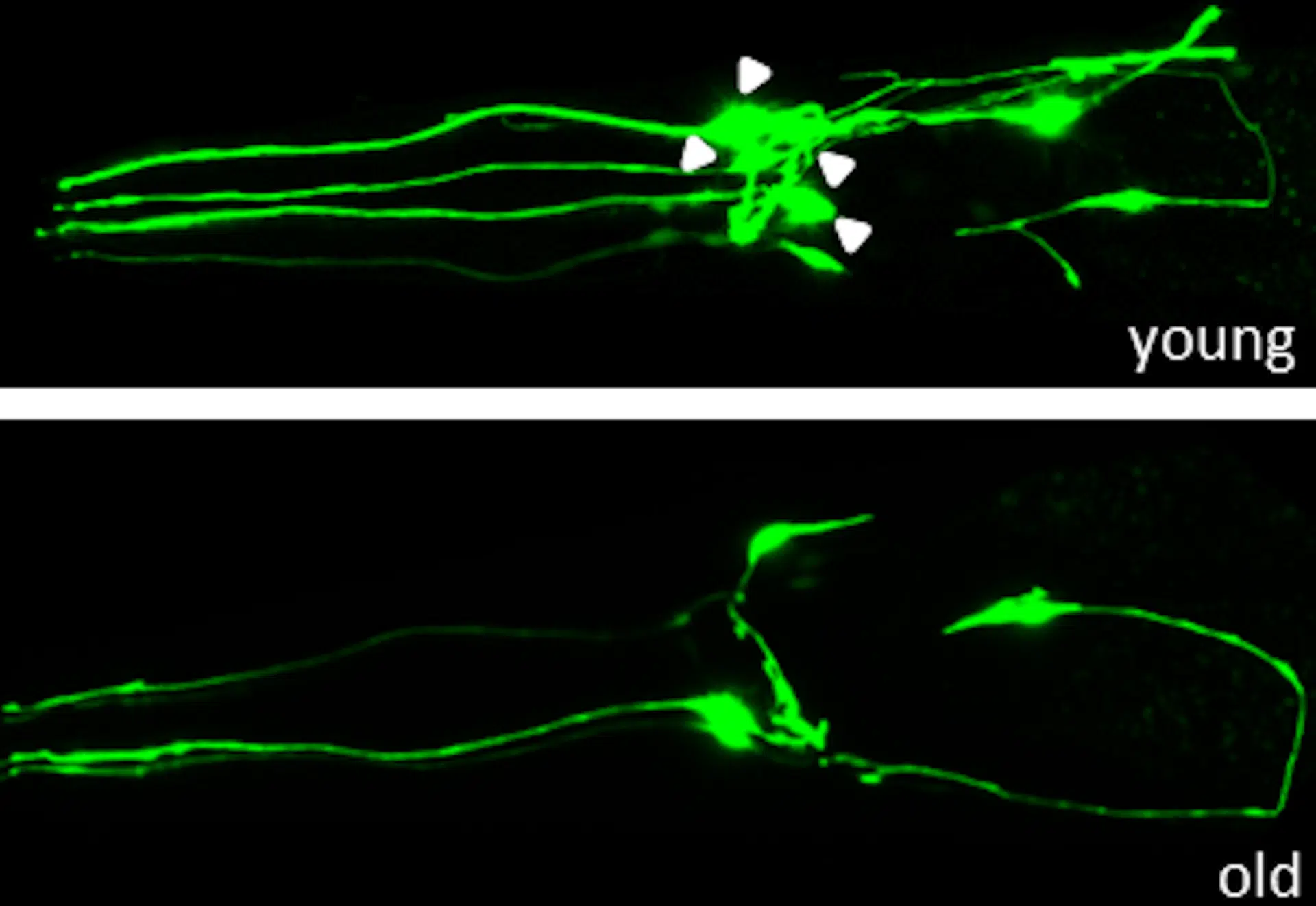 The Deterioration Of Neurons In Worms With Age