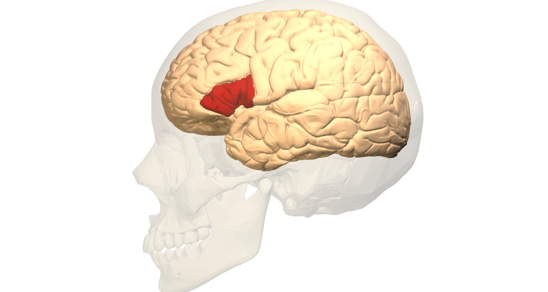 A transparent skull over a white background holds a tan brain with an area in the middle a deep red.