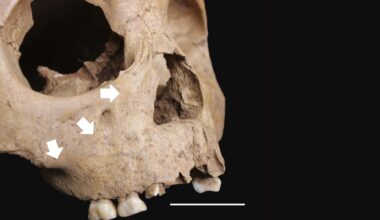 A close up of a skull with white arrows pointing to various areas on its bony cheeks with a dark background behind