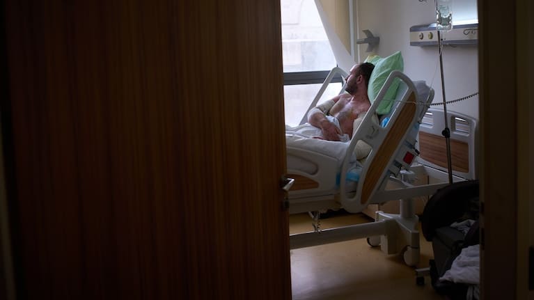 A man with burn wounds from an Israeli airstrike on southern Lebanon lying in bed at the Sidon Government Hospital in Sidon, Lebanon, Thursday, April 2, 2026.