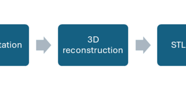 Anatomically Accurate 3D-Printed Thoracic Model With Artificial Skin for Chest Drainage Training