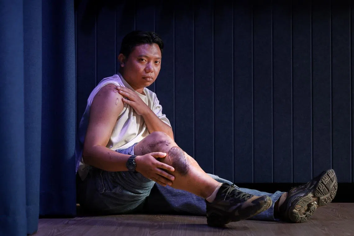 Motorcyclist Mahmud Azmani Fikri now has a metal rod in his right leg and multiple screws in his neck and shoulders.