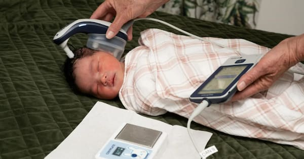 New invention lets newborn babies sleep during hearing checks